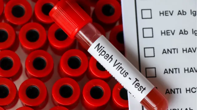 Virus Nipah là gì và vì sao được WHO xếp vào nhóm mầm bệnh ưu tiên?