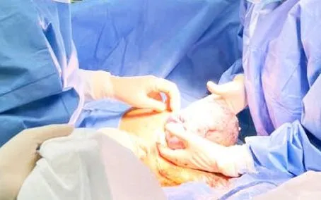 Kích hoạt báo động đỏ cứu bệnh nhân nguy kịch do tiền sản giật nặng