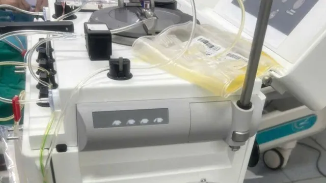 Tách huyết tương cứu bệnh nhân viêm tụy cấp do tăng triglycerid