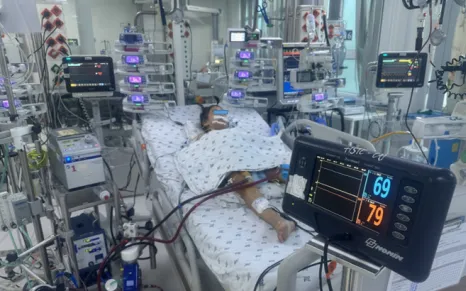 Cứu sống bệnh nhi viêm cơ tim tối cấp nhờ kỹ thuật ECMO