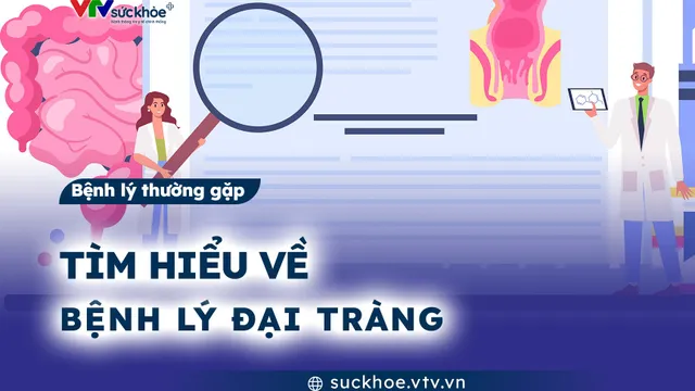 Tìm hiểu về bệnh lý đại tràng