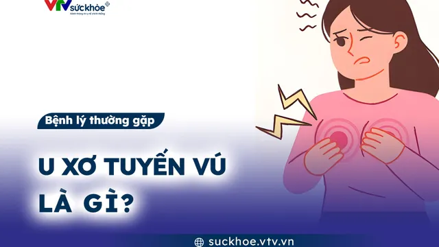 U xơ tuyến vú là gì?