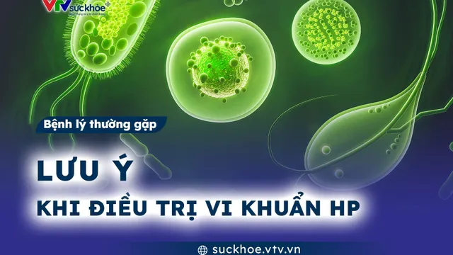 Lưu ý khi điều trị vi khuẩn HP