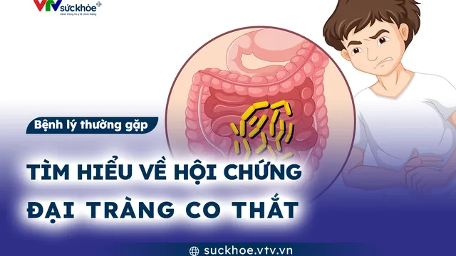 Tìm hiểu về hội chứng đại tràng co thắt