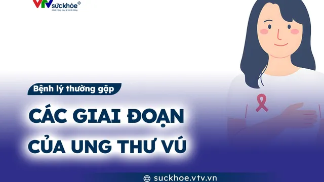 Các giai đoạn của ung thư vú