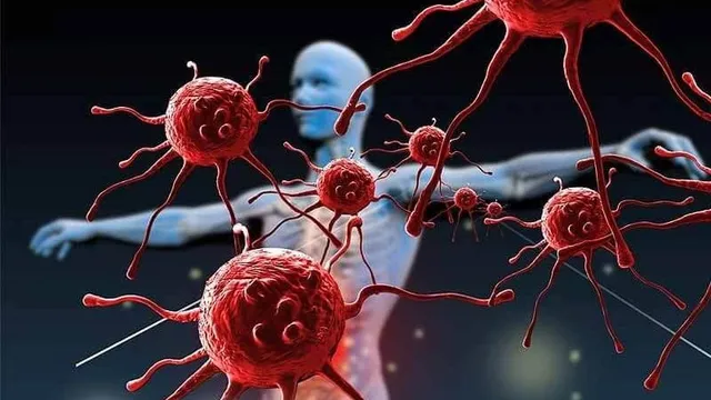 Bệnh tự miễn: Khi miễn dịch tấn công cơ thể