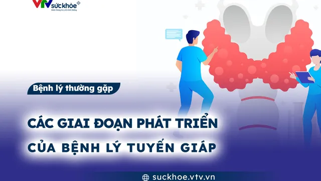 Các giai đoạn phát triển của bệnh lý tuyến giáp