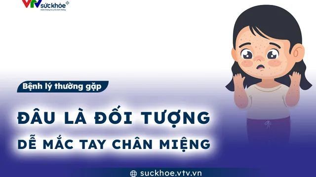 Đâu là đối tượng dễ mắc tay chân miệng?