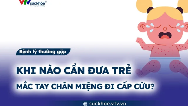Khi nào cần đưa trẻ mắc tay chân miệng đi cấp cứu?