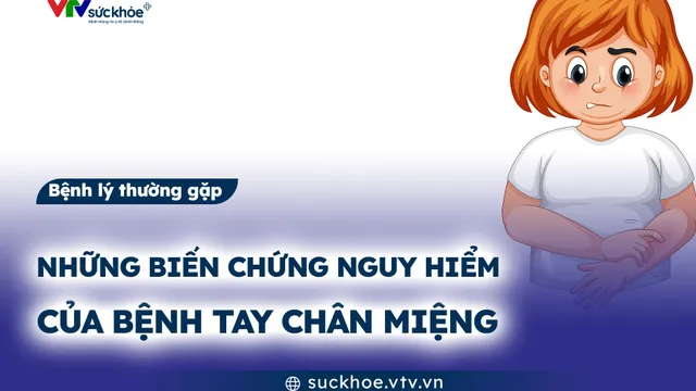 Những biến chứng nguy hiểm của bệnh tay chân miệng