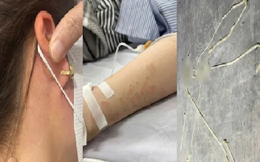 Gia tăng ca nhiễm đa ký sinh trùng: Xuất hiện nhiều trường hợp hiếm gặp