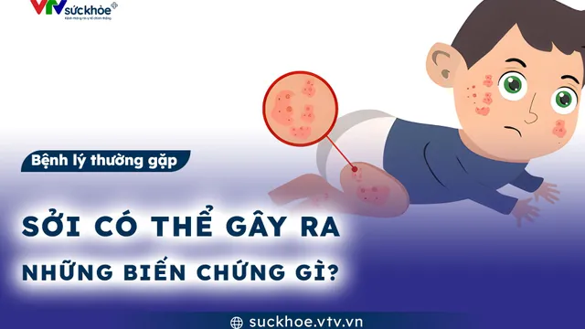 Sởi có thể gây ra những biến chứng gì?