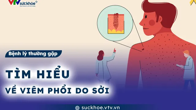 Tìm hiểu về viêm phổi do sởi