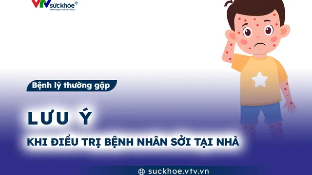 Lưu ý khi điều trị bệnh nhân sởi tại nhà