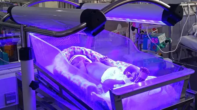 Chạy đua cứu não bé sơ sinh mang nhóm máu hiếm