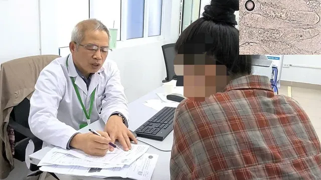 Viêm da mặt do ký sinh trùng Demodex