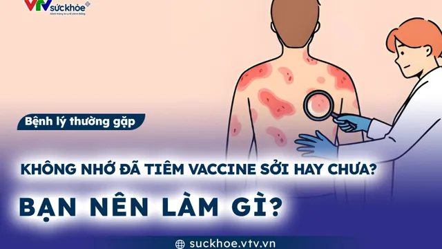 Không nhớ đã tiêm vaccine sởi hay chưa? Bạn nên làm gì?