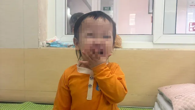 Bệnh tay chân miệng có thể khởi phát không điển hình, dễ bỏ sót ở trẻ nhỏ