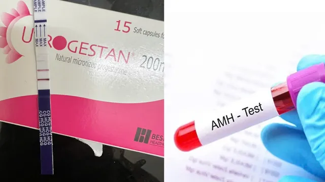 AMH thấp vẫn có con khỏe nhờ IVF không kích trứng