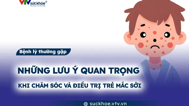 Những lưu ý quan trọng khi chăm sóc và điều trị trẻ mắc sởi