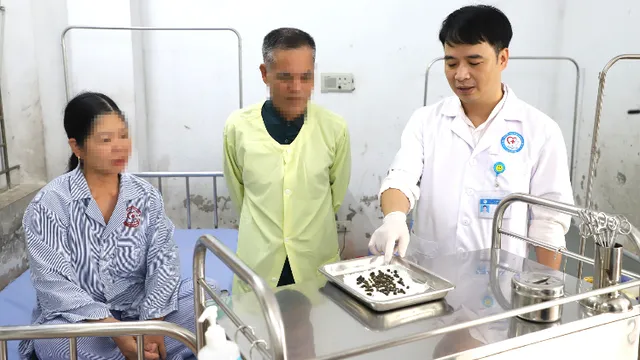 Cơ thể chứa hơn 300 viên sỏi túi mật sau 10 năm trì hoãn điều trị