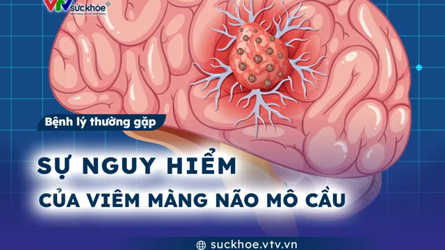 Sự nguy hiểm của viêm màng não mô cầu