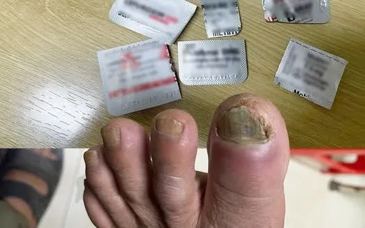 Đừng tự ý dùng thuốc khi chưa thăm khám