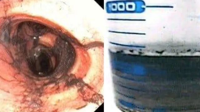 TP Hồ Chí Minh: Phác đồ chuẩn góp phần cứu sống nạn nhân ngạt khói vụ cháy tại Tân Thới Hiệp