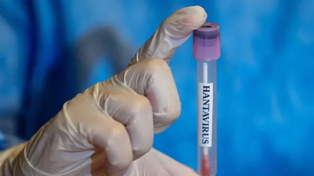 Bộ Y tế cập nhật thông tin về bệnh do virus Hanta