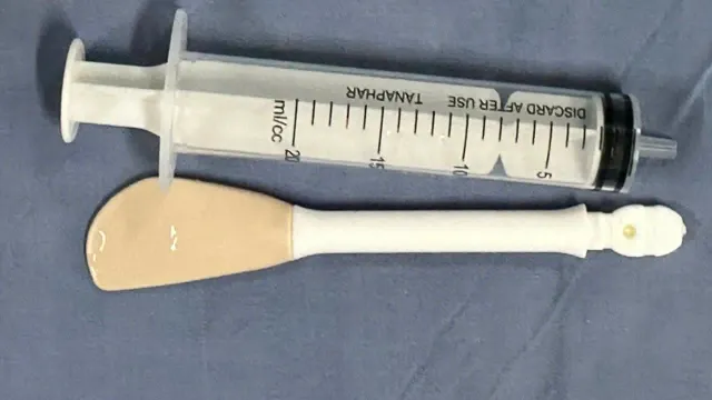 Gắp thành công bàn chải dài 30cm trong dạ dày bệnh nhân
