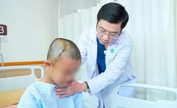 Mổ sọ tỉnh cứu bé trai có u não vùng nguy cơ cao