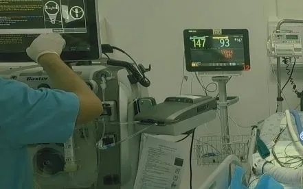 Nỗ lực cứu bé trai bỏng hơn 90% cơ thể sau một vụ cháy