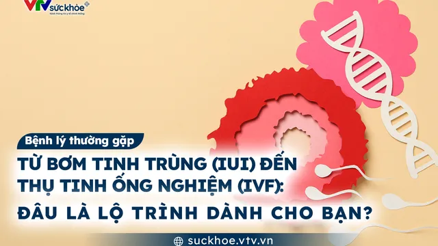 Từ bơm tinh trùng (IUI) đến thụ tinh ống nghiệm (IVF): Đâu là lộ trình dành cho bạn?