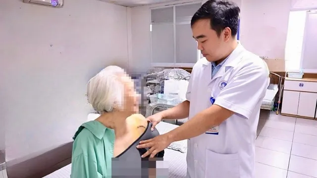 Nhập viện với dấu hiệu đột quỵ, bác sĩ phát hiện nguyên nhân từ trật khớp vai cũ