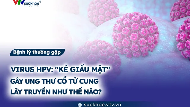 Virus HPV: "Kẻ giấu mặt" gây ung thư cổ tử cung lây truyền như thế nào?