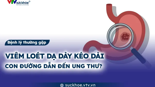 Viêm loét dạ dày kéo dài - Con đường dẫn đến ung thư?