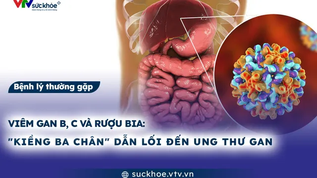 Viêm gan B, C và rượu bia: "Kiềng ba chân" dẫn lối đến ung thư gan