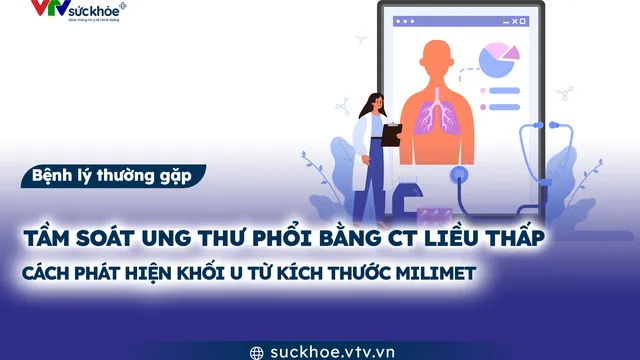 Tầm soát ung thư phổi bằng CT liều thấp: Cách phát hiện khối u từ kích thước milimet