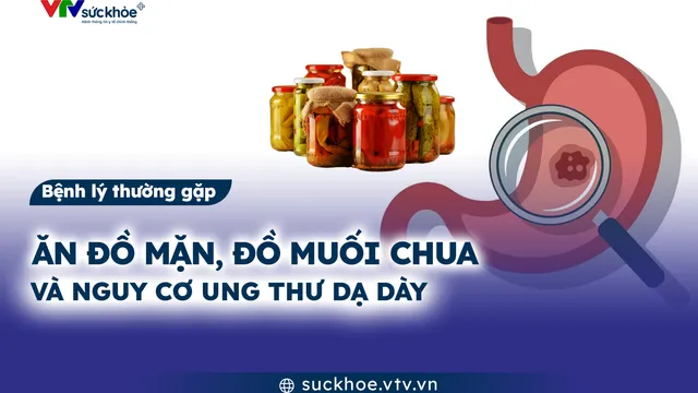 Ăn đồ mặn, đồ muối chua và nguy cơ ung thư dạ dày