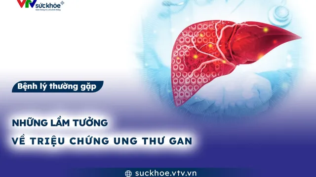 Những lầm tưởng về triệu chứng ung thư gan