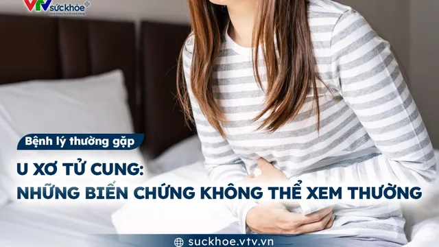 U xơ tử cung: Những biến chứng không thể xem thường