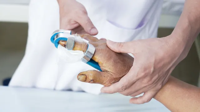 Bỏng nặng do điện thoại phát nổ khi đang sạc