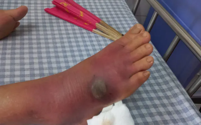 Chuột Cắn Vào Chân Đánh Con Gì? Giải Mã Điềm Báo Và Con Số May Mắn