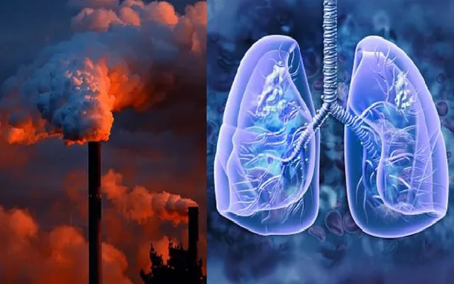 Gia tăng ung thư phổi ở người không hút thuốc do ô nhiễm không khí | VTV.VN
