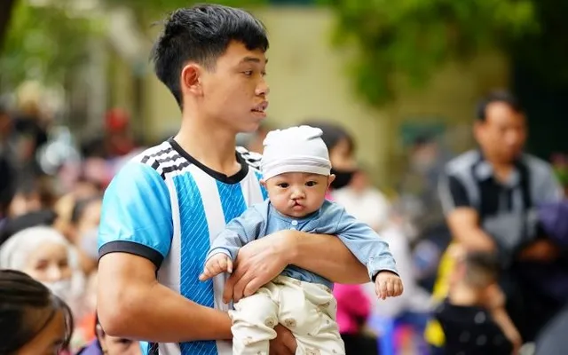 Gần 60 trẻ em được phẫu thuật khe hở môi - vòm miệng miễn phí