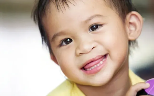 Khám sàng lọc và phẫu thuật miễn phí cho trẻ em khuyết tật tại Cao Bằng