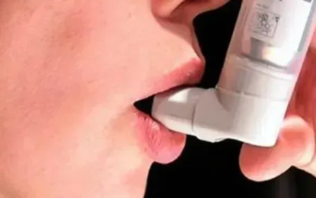 Ngày Hen toàn cầu 2025: Giáo dục về hen giúp trao quyền cho người bệnh