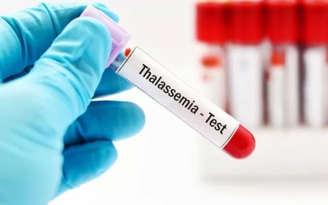 Ngày Thalassemia Thế giới 2025: Chung tay vì một thế hệ khỏe mạnh
