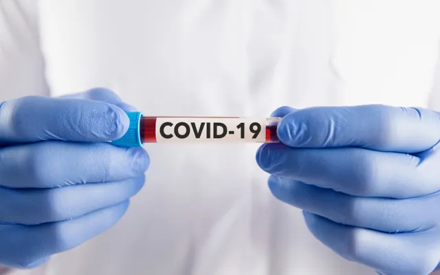 Hơn 25 nghìn ca nhiễm COVID-19 trên thế giới trong vòng gần một tháng, Bộ Y tế khuyến cáo chủ động phòng ngừa