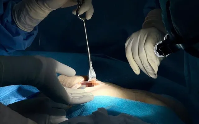 Breast firmness after augmentation: Signs, causes, and treatment